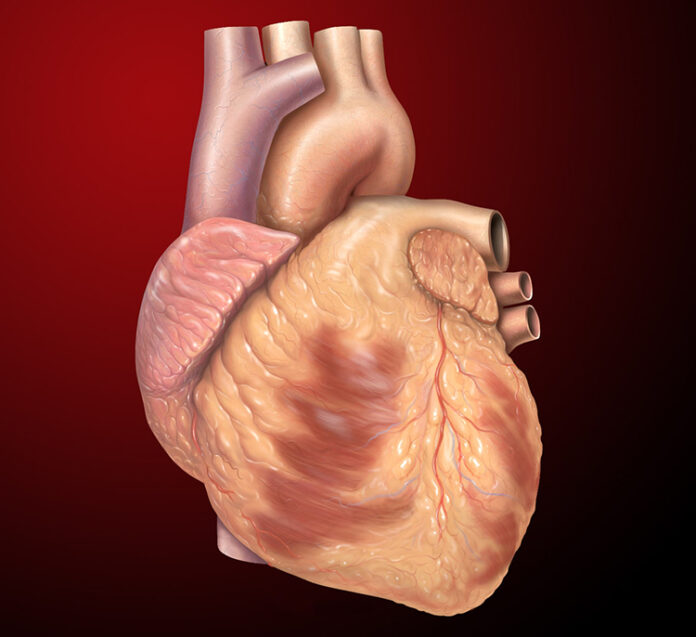 علائم نقص سپتوم دهلیزی