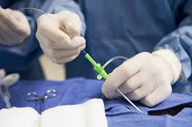 آنژیوگرافی قلب از طریق شریان پا چگونه انجام می شود؟