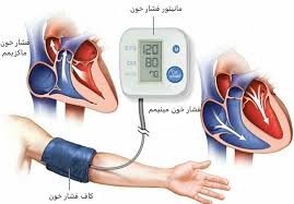 فشار خون بالا – قاتل خاموش